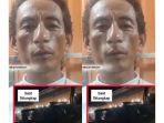 Juru-parkir-resmi-Aprizal-dianiaya-polisi-supaya-ngaku-preman.jpg