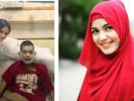 13 Tahun Lalu Ditabrak Nadya Almira, Adnan Syuhada Kini Lumpuh, Keluarga Tuntut Tanggungjawab