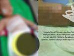 Viral-Bayi-3-tahun-kecemplung-panci-sayuran-panas-di-Ponorogo.jpg