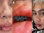 Wajah-hingga-Lidah-Melepuh-Kartika-Putri-Tak-Terima-Disebut-Kena-Karma-Nggak-Punya-Hati-Nurani.jpg