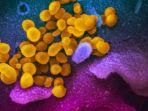 gambar-mikroskop-elektron-pemindai-menunjukkan-virus-corona-wuhan-atau-covid-19.jpg