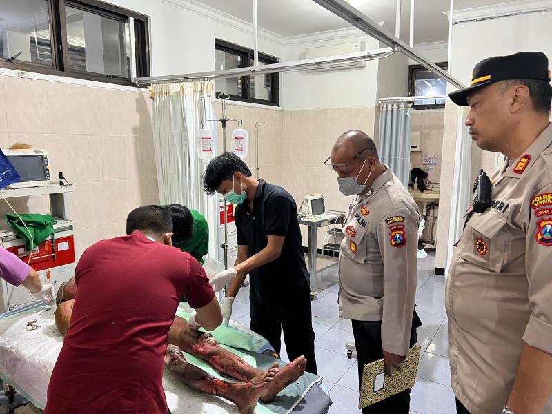Setelah Jalani Perawatan, Istri yang Dibakar Suami di Banyuwangi Dinyatakan Meninggal Dunia