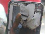 korban-penyiraman-minyak-panas.jpg