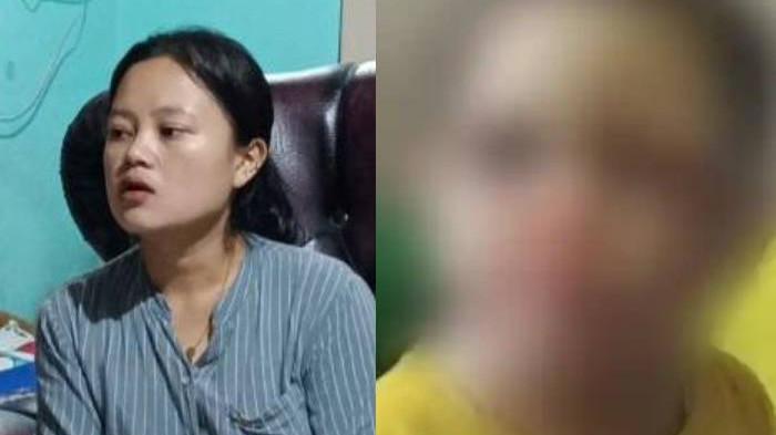 BUKAN KEKERASAN - Indah Marlianti (23) mengungkap kondisi anaknya, SA (2). Dia mengatakan, lebam bukan karena tindak kekerasan, melainkan penyakit langka.