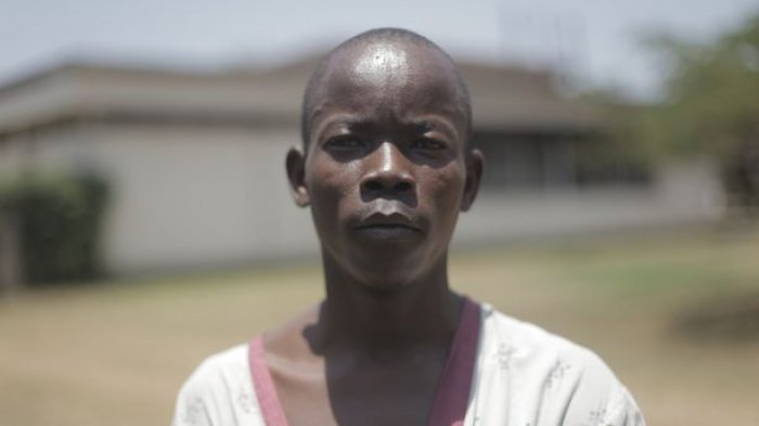 Punya Alat Vital Terbesar di Dunia, Pria ini Sekarang Alami Nasib Mengerikan