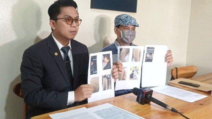 Tak Bayar Utang Rp300 Juta, Pemuda Disiksa 30 Orang & Disekap 3 Bulan, Lapor Polisi sempat Ditolak
