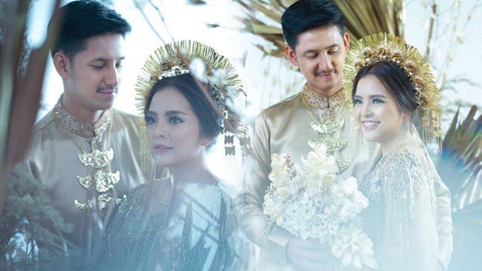 Gunakan Make Up Freckles, Intip Nih Foto-foto Prewedding Tasya Kamila dan Randi Bachtiar