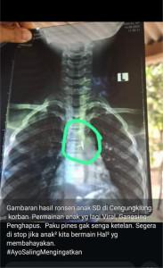 Darim-50-warga-Desa-Cengungklung-Kecamatan-Gayam-Kabupaten-Bojonegoro.jpg