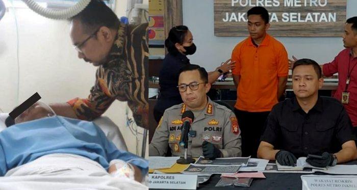 Dokter Beber Kondisi Otak David Sebenarnya Pasca Dianiaya Mario, Potensi Cacat hingga Harapan Hidup