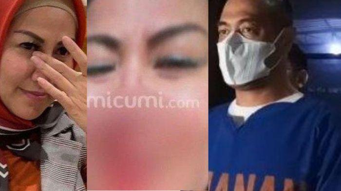 Ferry-Irawan-Venna-Melinda-fakta-darah.jpg