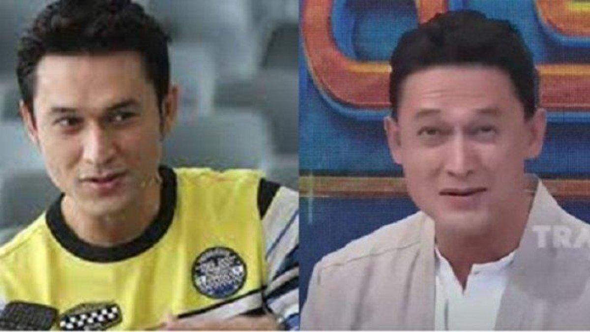 Kabar Terkini Indra Bruggman yang Idap Hipertiroid, Kantung Mata Sempat Membesar Sebelah