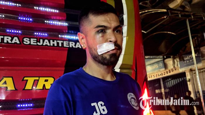 Insiden Horor Julian Guevara di Laga Arema FC vs Dewa United, Gegar Otak Sedang dan 10 Jahitan Bibir