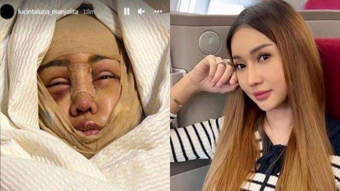 Tak Puas Oplas 20 Kali, Lucinta Luna Bakal Rombak Hidung Demi Mirip Jennie Blackpink: Berubah Wujud