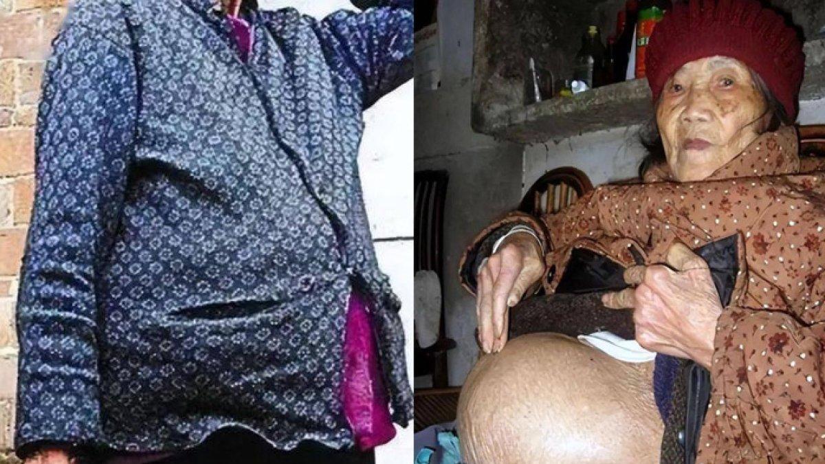 Nenek 91 Tahun Hamil, Dokter Syok saat Lihat USG, Rahasia 60 yang Tersimpan Kini Terbongkar