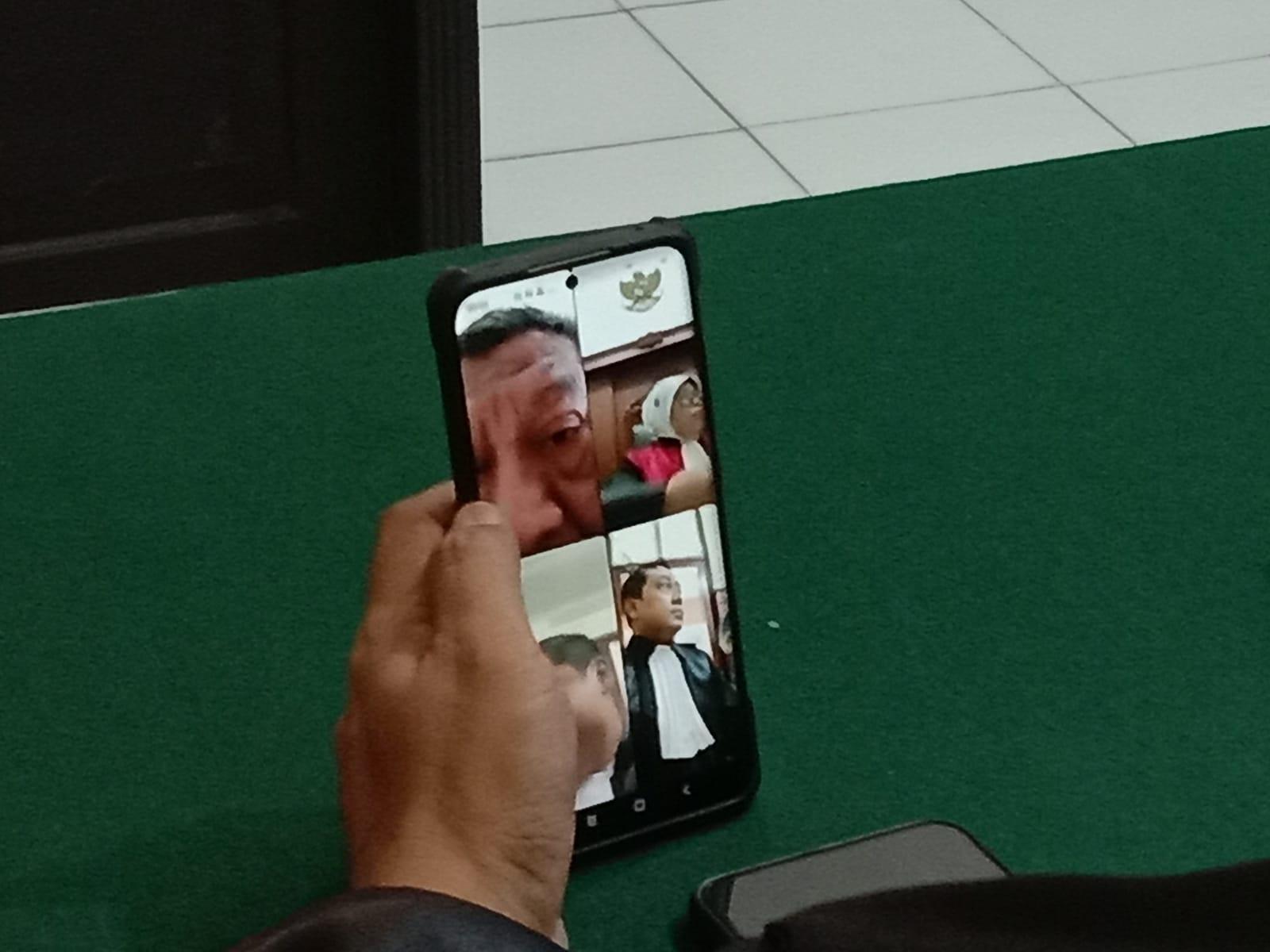 Admin Koperasi Rumah Sakit di Surabaya Diadili, Diduga Gelapkan Uang Senilai Rp 4 Miliar