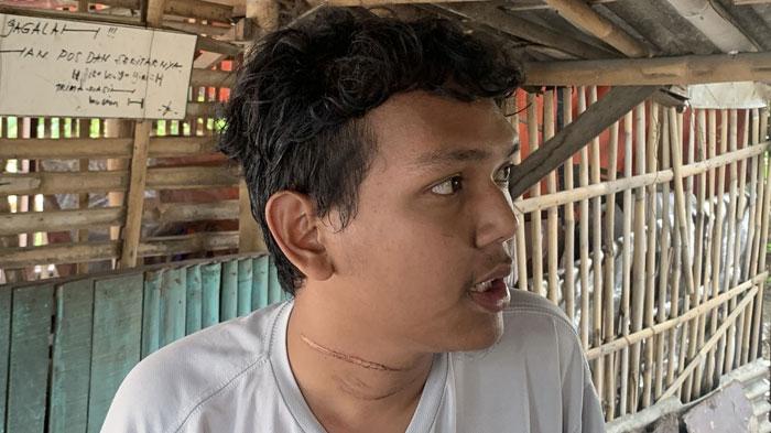 Kabel Menjuntai Bikin Leher Mahasiswa Pengendara Motor Terjerat: Kalau Ngebut Saya Sudah Tewas