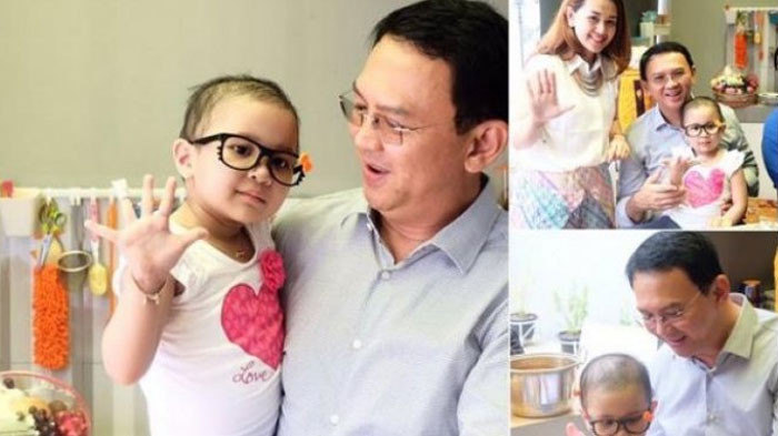Kabar Mengharukan Datang dari Bocah Pengidap Leukemia yang Pernah Dijenguk Ahok 11 Bulan Lalu