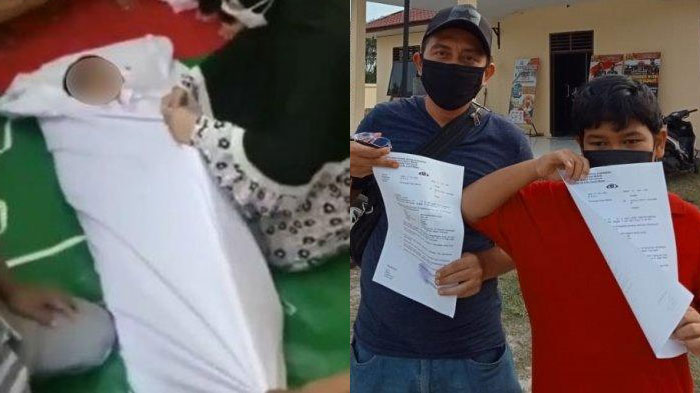 Tragedi Bocah Meninggal Pasca Rabies Digigit Anjing, Sempat Berjuang Laporkan Tetangga ke Polisi