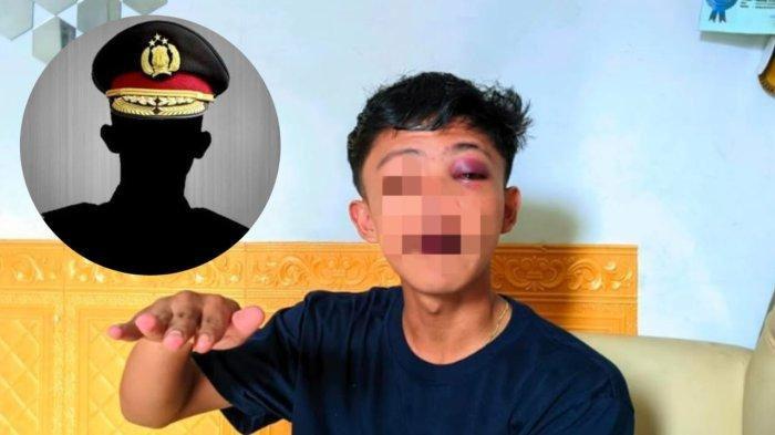 dianiaya-polisi-pelajar-di-Gorontalo-diberi-uang-tutup-mulut-Rp50-ribu.jpg