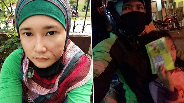 Ibu Muda Ini Tak Menyerah untuk Tetap 'Ngaspal' Meski Wajah Terluka Akibat Kecelakaan Saat Ngojek