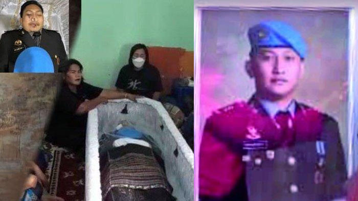 Kejanggalan Fisik Jenazah Brigadir J, Autopsi Ulang Disaksikan 1 Orang Keluarga: Cek 2 Bagian Ini