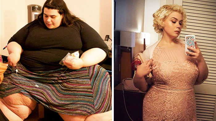 10 Foto Sebelum dan Sesudah Diet Ini Bikin Melongo, No 8 Tunjukkan Gak Ada yang Gak Mungkin