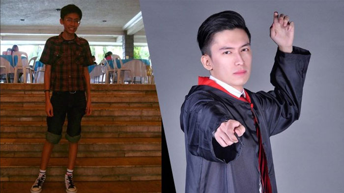 Kecilnya Bergigi Kelinci dan Jerawatan, Lihat Foto Dewasanya Berubah Drastis, Netizen Pun Histeris