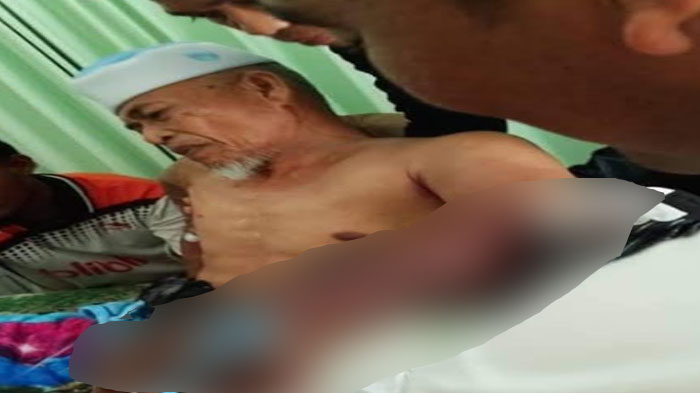 Sakitnya Kiai Pengasuh Ponpes di Pamekasan Digigit Ular Beludak Hingga Tangan Bengkak, Dirawat di RS