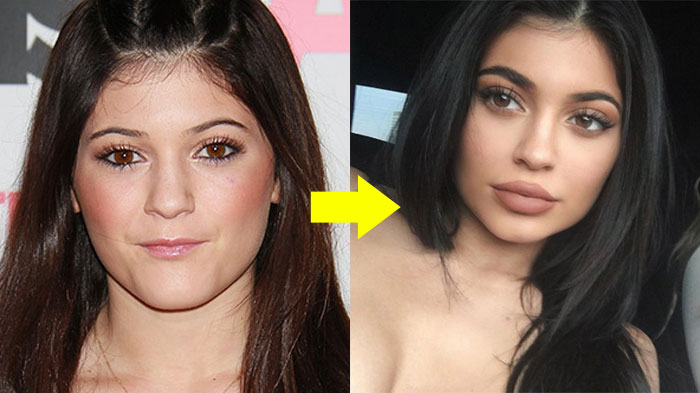 5 Cara Mudah Ini Bakal Bikin Bibir Kamu Tampak Penuh Alami, Lupakan Deh Filler yang Kuras Dompet!