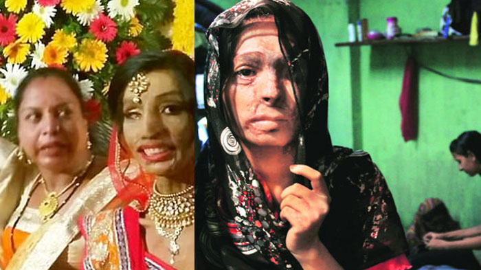 Putus Asa Wajahnya Tersiram Air Keras, Hidup Wanita Ini Malah Berubah Usai Salah Tekan Nomor Telepon