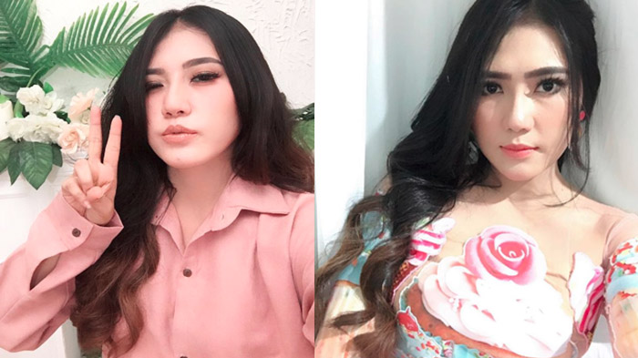 Bantah Wajahnya Suntik Putih, Foto Via Vallen Remaja Lagi Selfie Bikin Netizen Shock: Kayak Arang