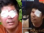 Donatur Nangis Dipanggil Polisi, Agus Salim Malah Tertawa Asyik Live TikTok Bak Artis: Bersyukur Aja
