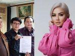 Ari-Bias-laporkan-Agnez-Mo-fbwhe48t45.jpg