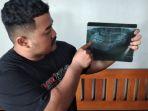 Davin-Ahmad-Sofyan-28-menunjukkan-foto-rontgen-gigi-bungsu-milik-istri-tercintanya.jpg