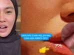Kartika-Putri-dengan-kondisi-wajah-terlihat-melepuh.jpg