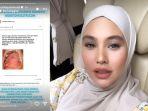 Kartika-Putri-dihujat-haters-terkait-penyebab-wajah-dan-lidahnya-melepuh.jpg