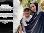 Kartika-Putri-tengah-berobat-di-Singapura-usai-wajahnya-terkena-penyakit.jpg