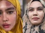 Kartika-Putri-ungkap-penyebab-wajahnya-ruam-dan-melepuh-jhw73454.jpg