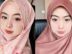 Kolase-foto-dr-Shindy-Putri-kakak-kandung-Ria-Ricis.jpg