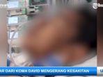 Kondisi-terkini-David-korban-Mario-Dandy-1.jpg