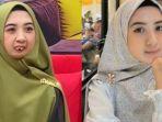 Sosok-Niatus-Sholihah-gadis-difabel-yang-ditawari-untuk-menjadi-staf-khusus.jpg