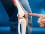 Total-Knee-Replacement-TKR.jpg