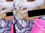 Viral-sebuah-video-yang-menunjukkan-operasi-tanpa-dijahit.jpg