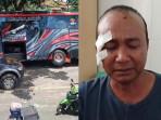 Zainuri-Menangis-Ingat-Detik-detik-Bus-RS-Bina-Sehat-Jember-Kecelakaan-di-Bromo.jpg