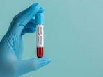 covid-19-varian-omicron-22.jpg