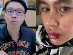 dr-Richard-Lee-tawari-Kartika-Putri-berobat-di-kliniknya.jpg