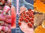 jahe-merah-virus-corona-dan-kunyit.jpg