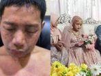 korban-air-keras-pernikahan-di-Bima.jpg