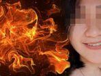 perawat-kecamatan-kalipare-dibakar.jpg