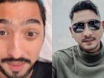 perubahan-tampilan-wajah-Arya-Saloka.jpg